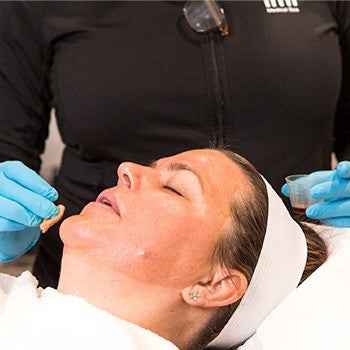 5 Questions to Ask Before Getting a Chemical Peel