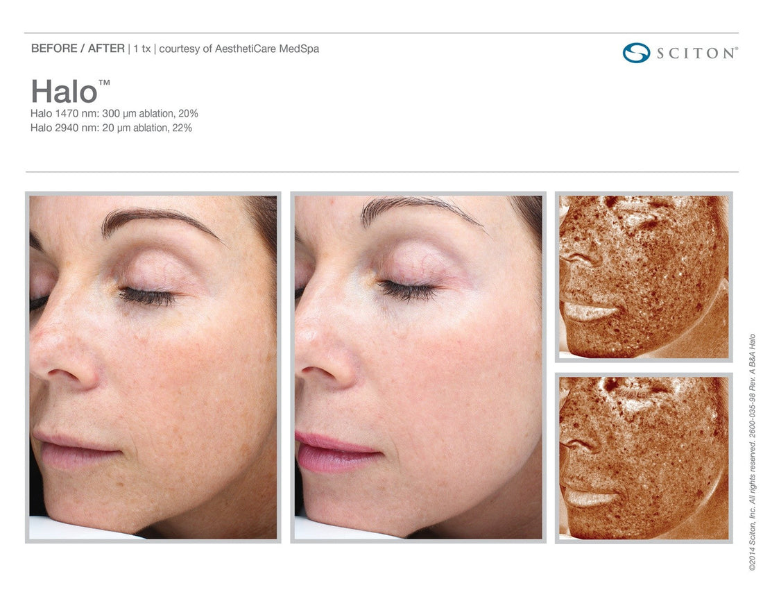 The Many Faces of Sciton® Laser Skin Treatments