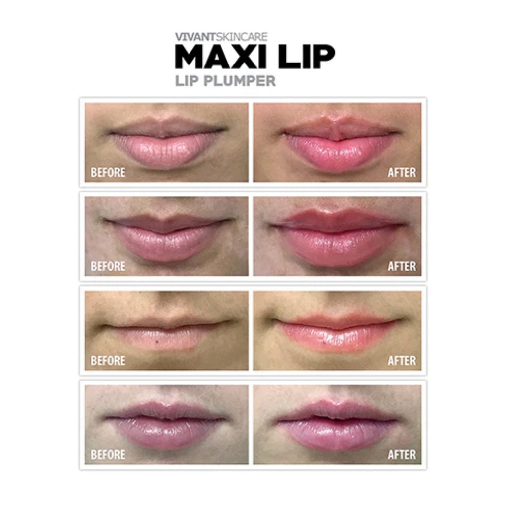 Maxi Lip Plumper before and after shots of lips