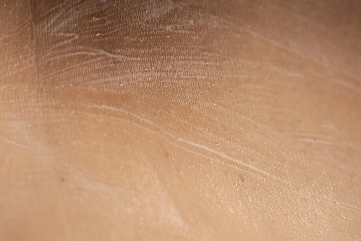 Close-up of skin texture, reference locations page banner
