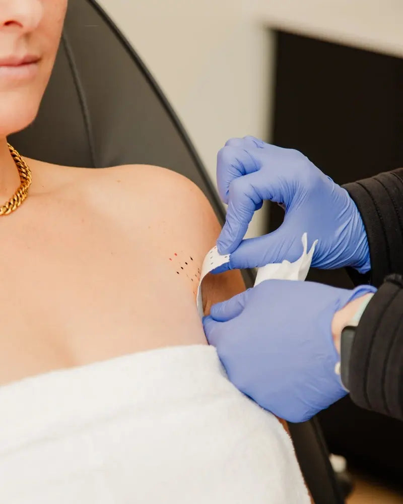 Close-up of a treatment area on the chin